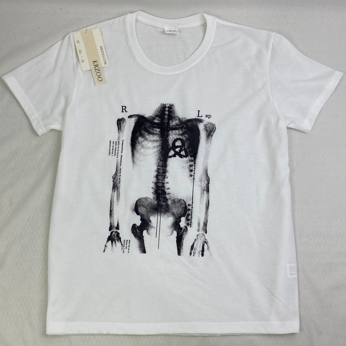X-ray Bone Print Black and White T-Shirt