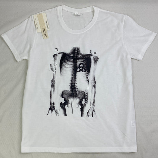 X-ray Bone Print Black and White T-Shirt